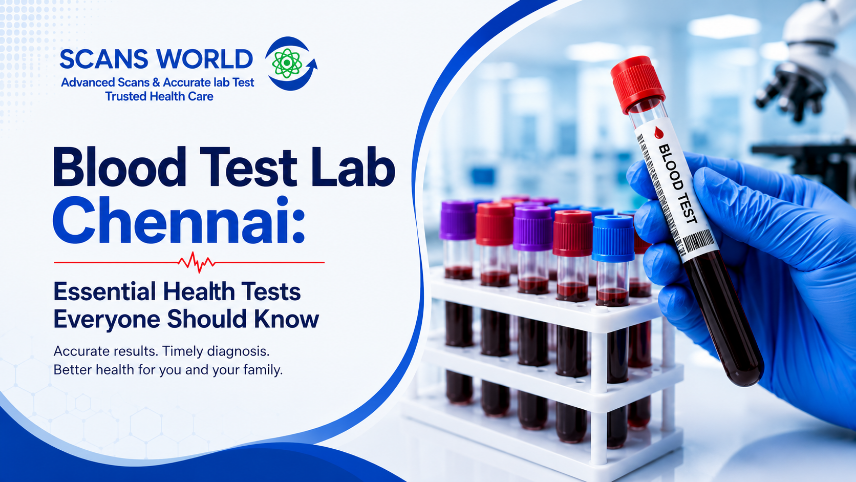 Blood Test Lab Chennai | Essential Health Tests You Need